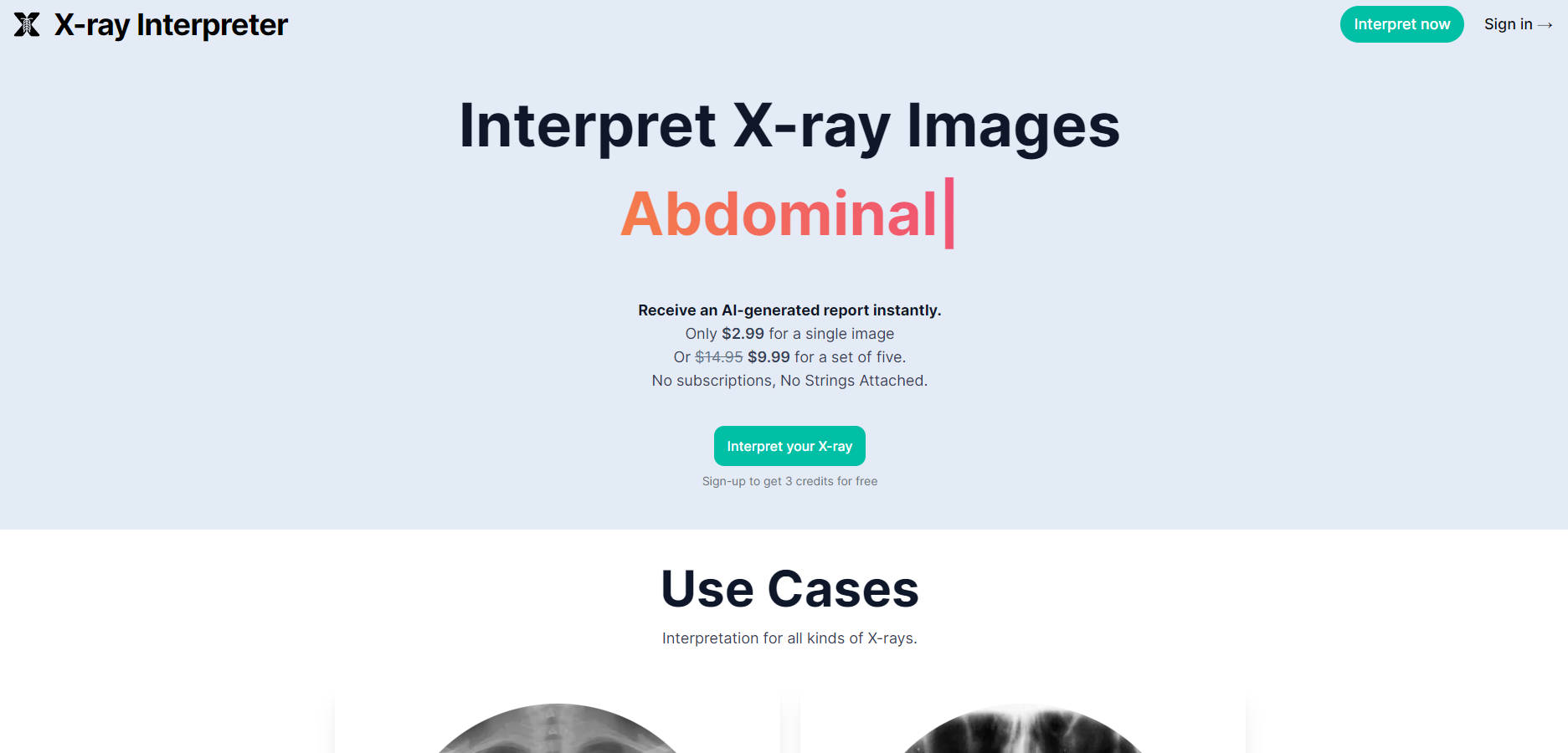 X-ray Interpret