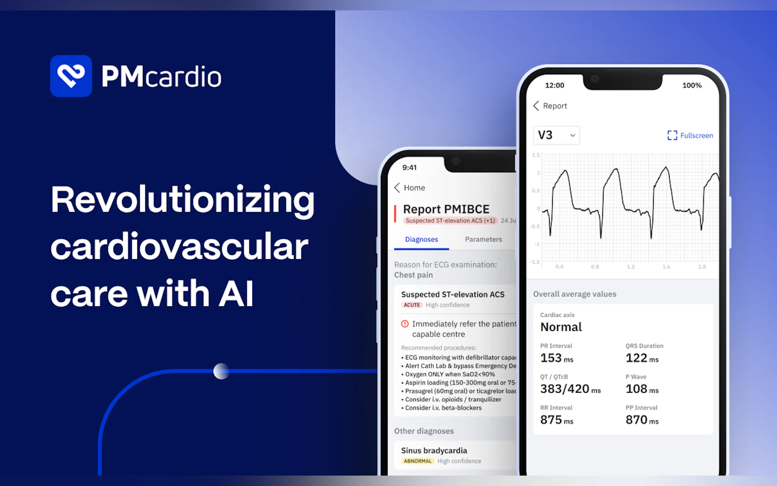 PMcardio gallery image