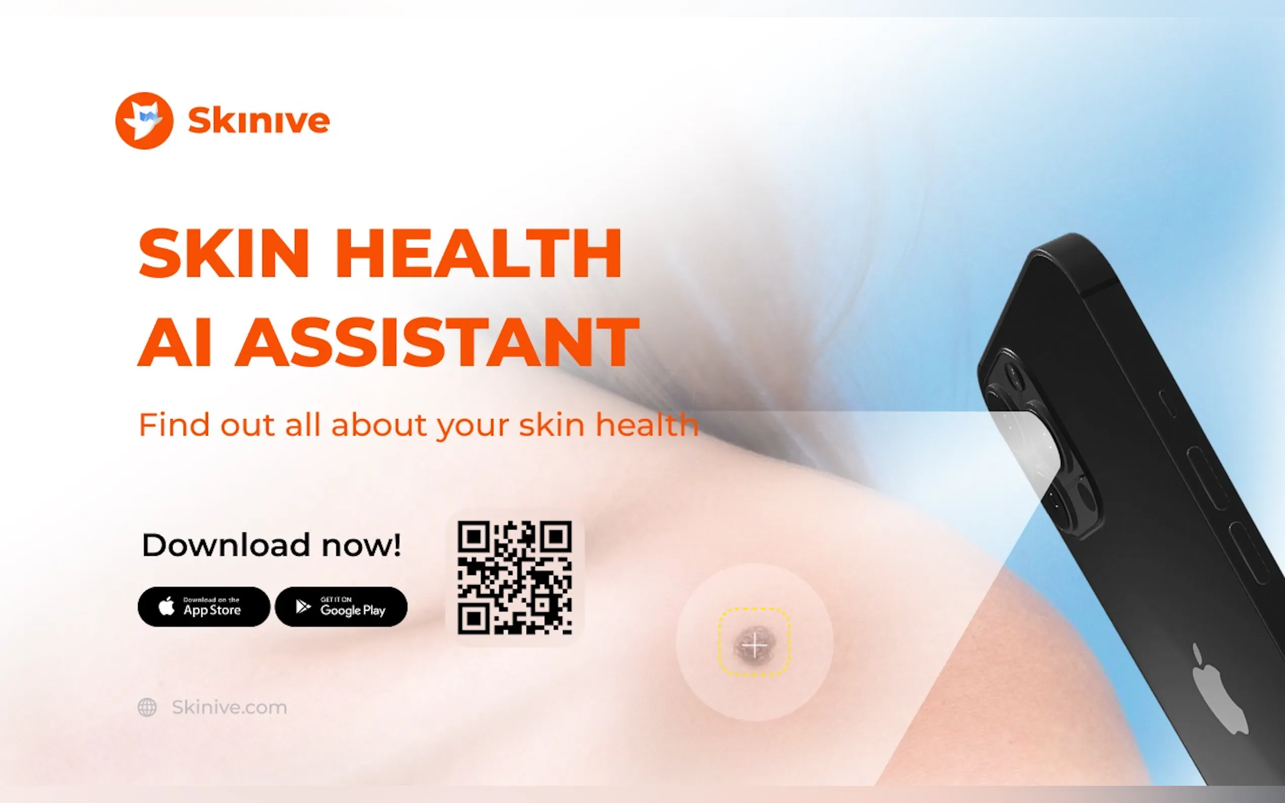Skinive gallery image