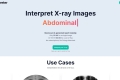 X-ray Interpret
